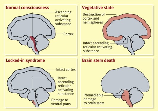 1 s2.0 s1357303908002429 gr1